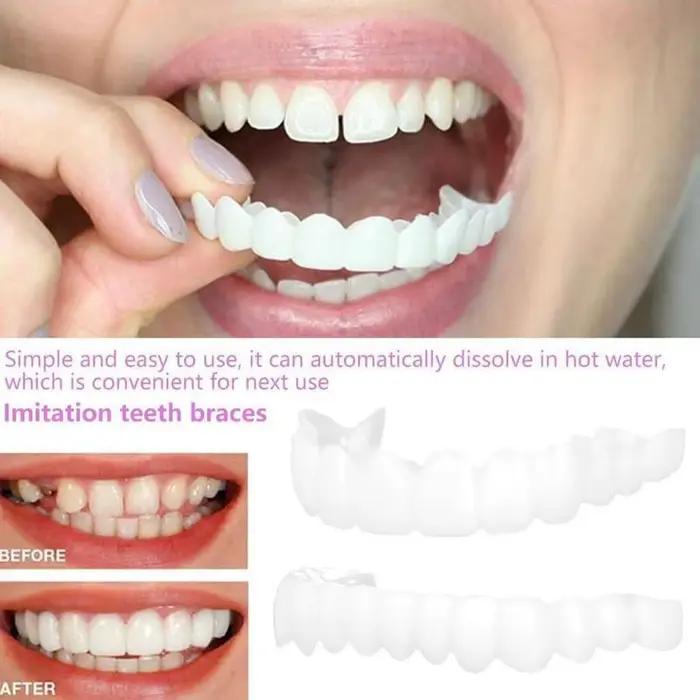 Facile à retirer, les facettes dentaires réutilisables pour un sourire instantané et un blanchiment facile, sans dommages H2931