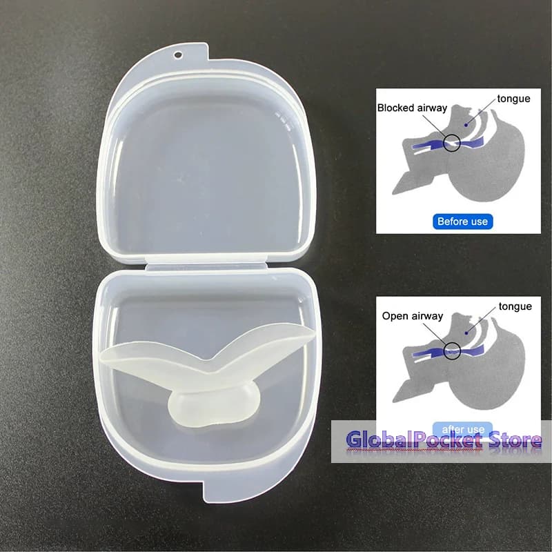 [TG823] Protège-langue en silicone pour le sommeil, aide respiratoire, dispositif anti-ronflement et
