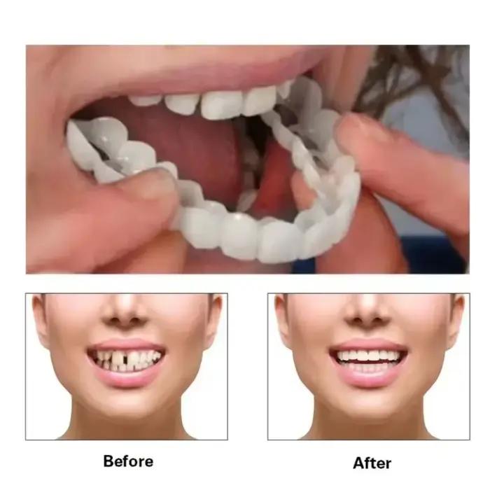 prothèses blanches - prothèses supérieures et inférieures réglables pour hommes et femmes, ajustement confortable et sourire naturel