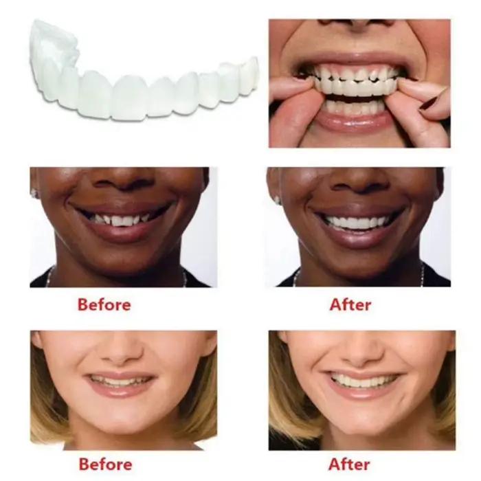 2 paires de prothèses dentaires à mâchoire supérieure et inférieure, soins pour prothèses dentaires, confort, protégez vos dents, fausses dents parfaites pour hommes et femmes