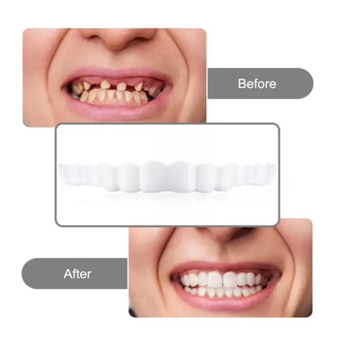 2 paires de prothèses dentaires à mâchoire supérieure et inférieure, soins pour prothèses dentaires, confort, protégez vos dents, fausses dents parfaites pour hommes et femmes