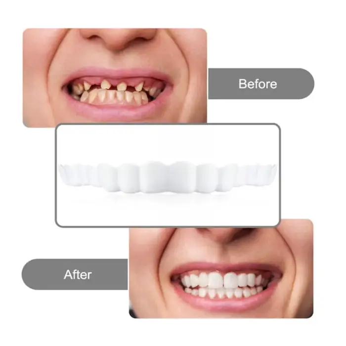 4-6 paires de prothèses dentaires à mâchoire supérieure et inférieure, soins pour prothèses dentaires, confort, protégez vos dents, fausses dents parfaites pour hommes et femmes
